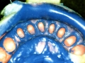 impronta-di-precisione